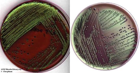 emb agar results